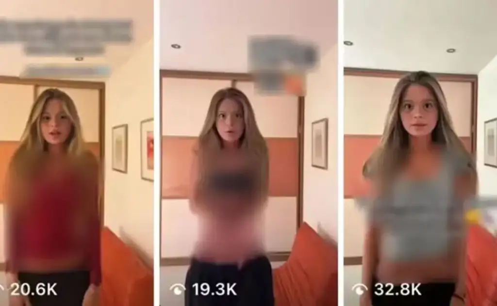Síndrome de Down